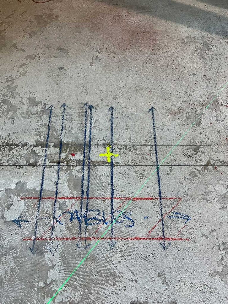 overlake medical center 5